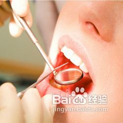 三叉神经痛治疗前期要做哪些检查呢