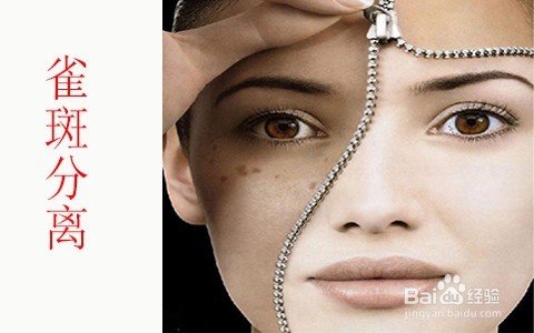 哺乳期能祛斑吗/吃奶时可以去雀斑吗