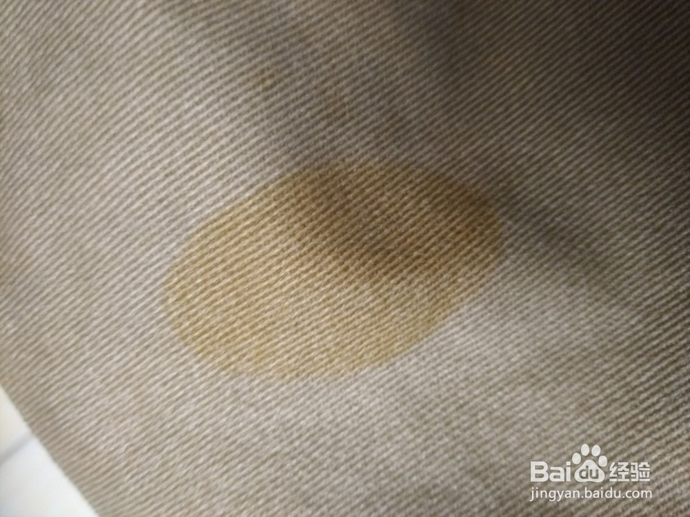 碘酒、碘伏弄到衣服上了怎么办?