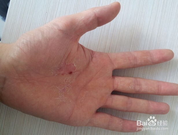 秋天养生注意事项