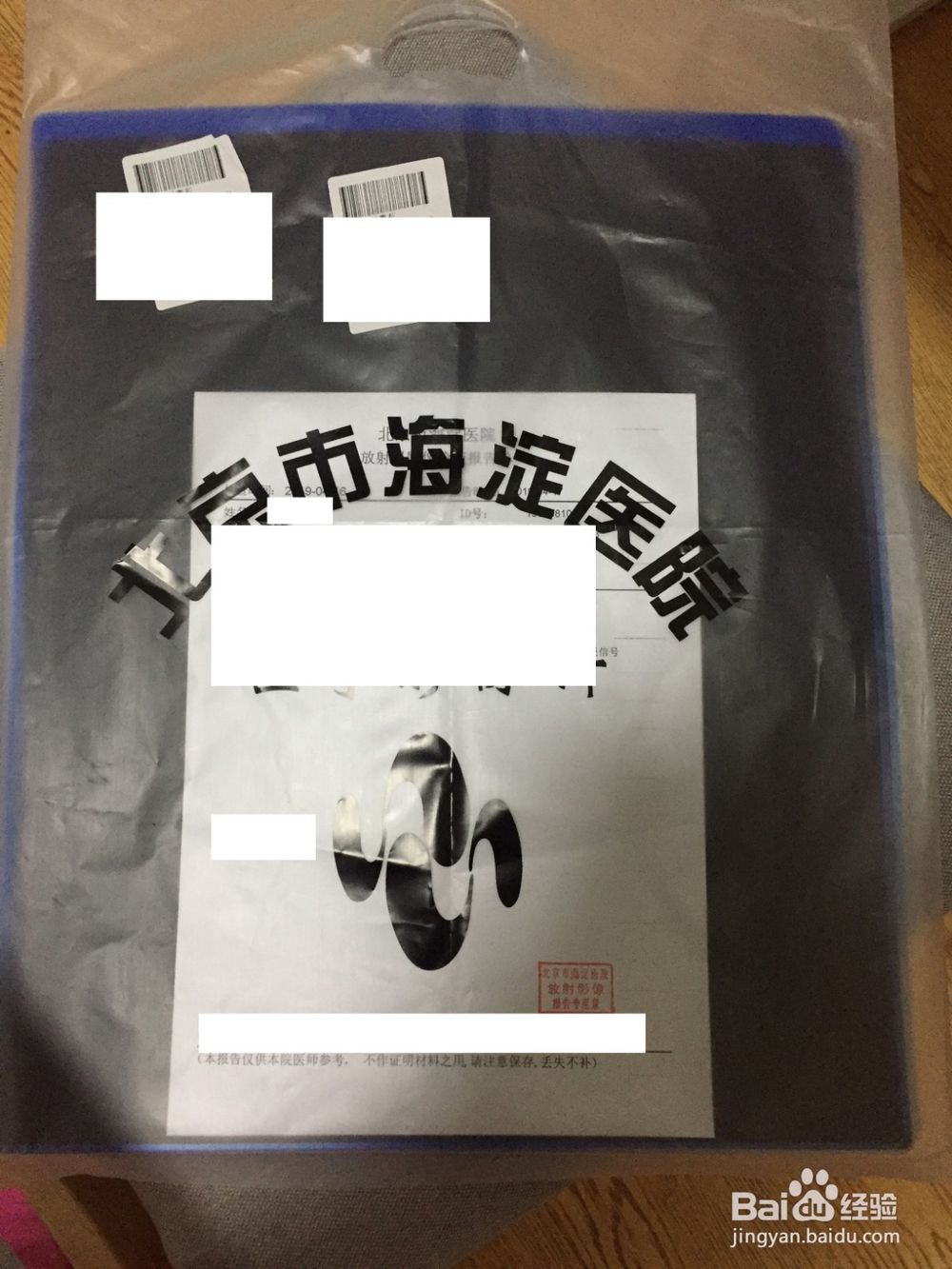 怎样在海淀医院做MRI核磁检查？