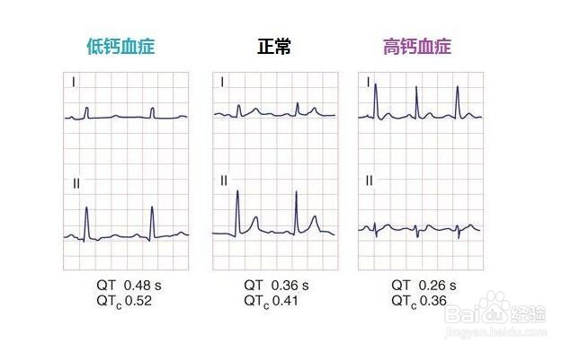 牛皮癣（银屑病）的预防方法与常见病因：