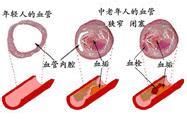 鸡皮肤怎么办鸡皮肤是什么原因引起的