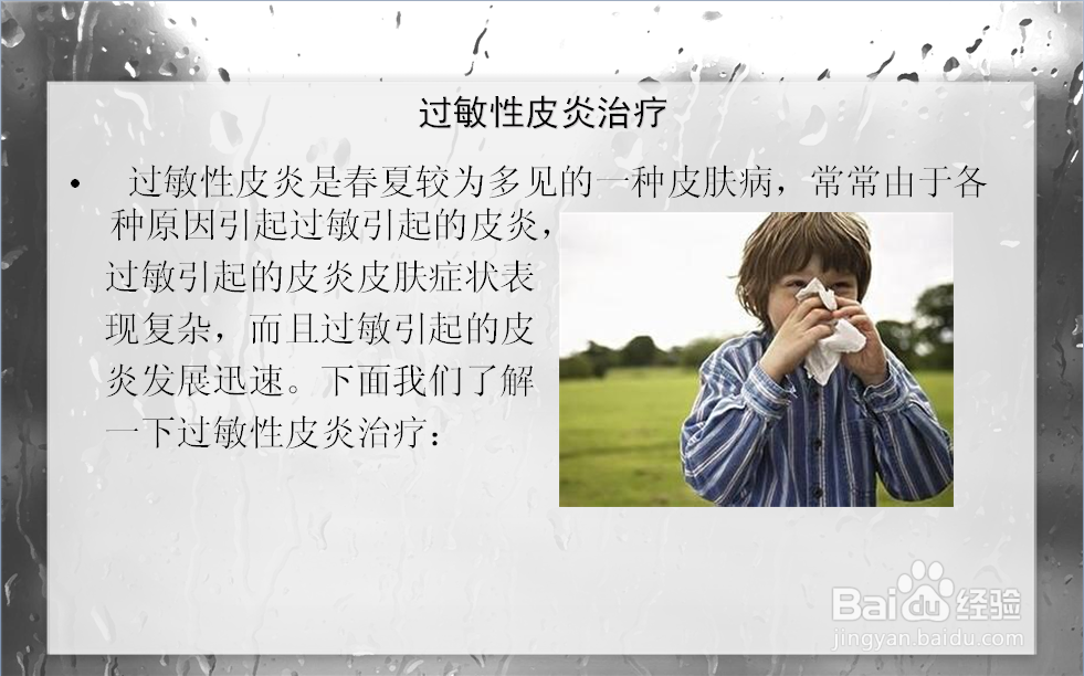 过敏性皮炎治疗