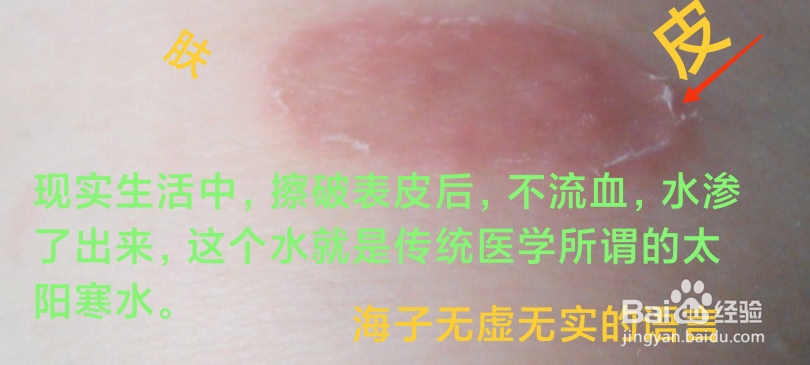 新冠病毒怎么消杀