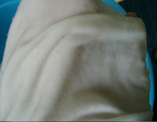 衣服上的油渍怎么洗？