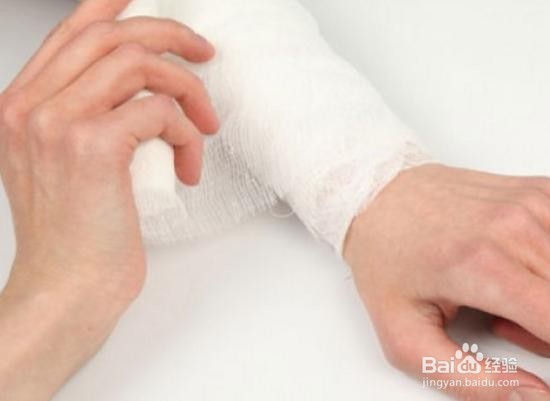 伤口有点化脓怎么办