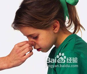 预防鼻出血的方法