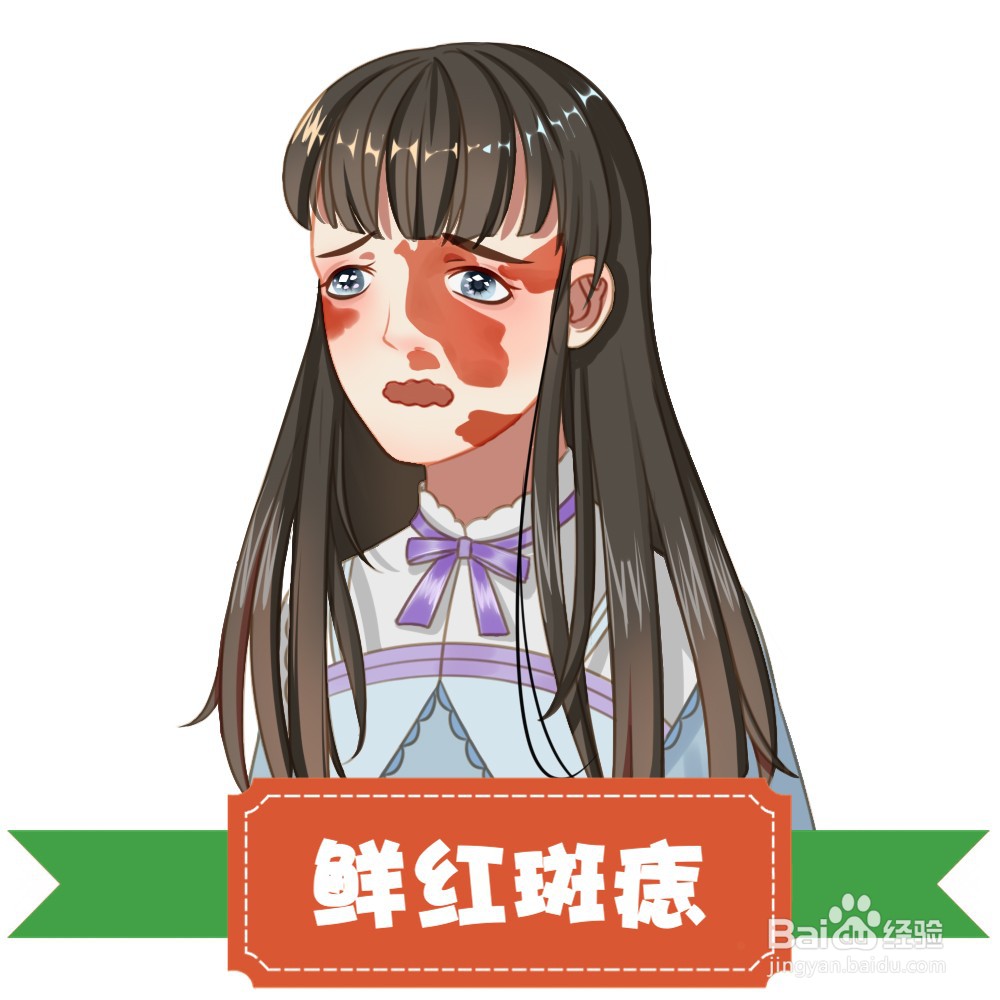 如何治疗胎记