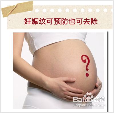 孕期产后不苦恼 3种方法有效去除妊娠纹