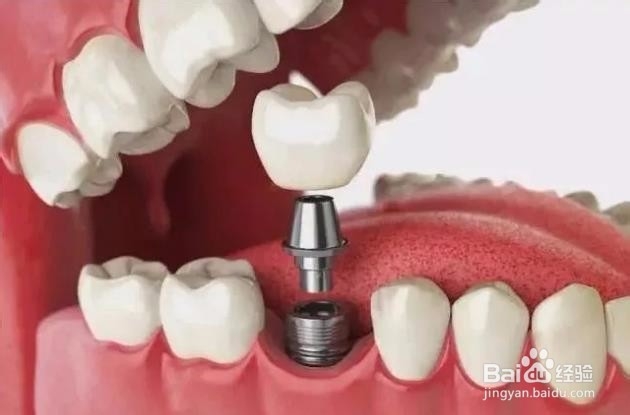 合肥牙科三甲医院有哪些-2019排行榜新鲜出炉啦