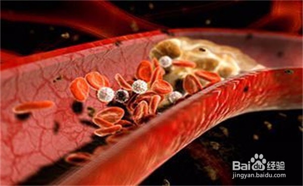 土豆的食用好处和禁忌