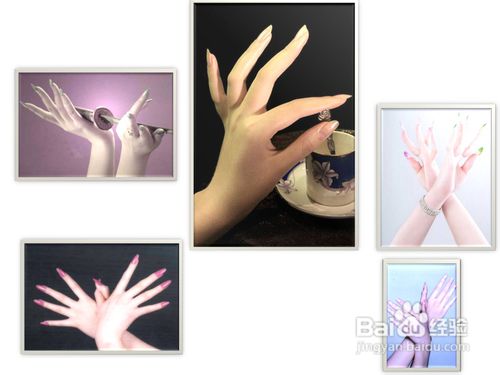 寒冬治疗和预防冻疮的经验