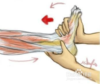 如何认知和应对肌肉痉挛的情况