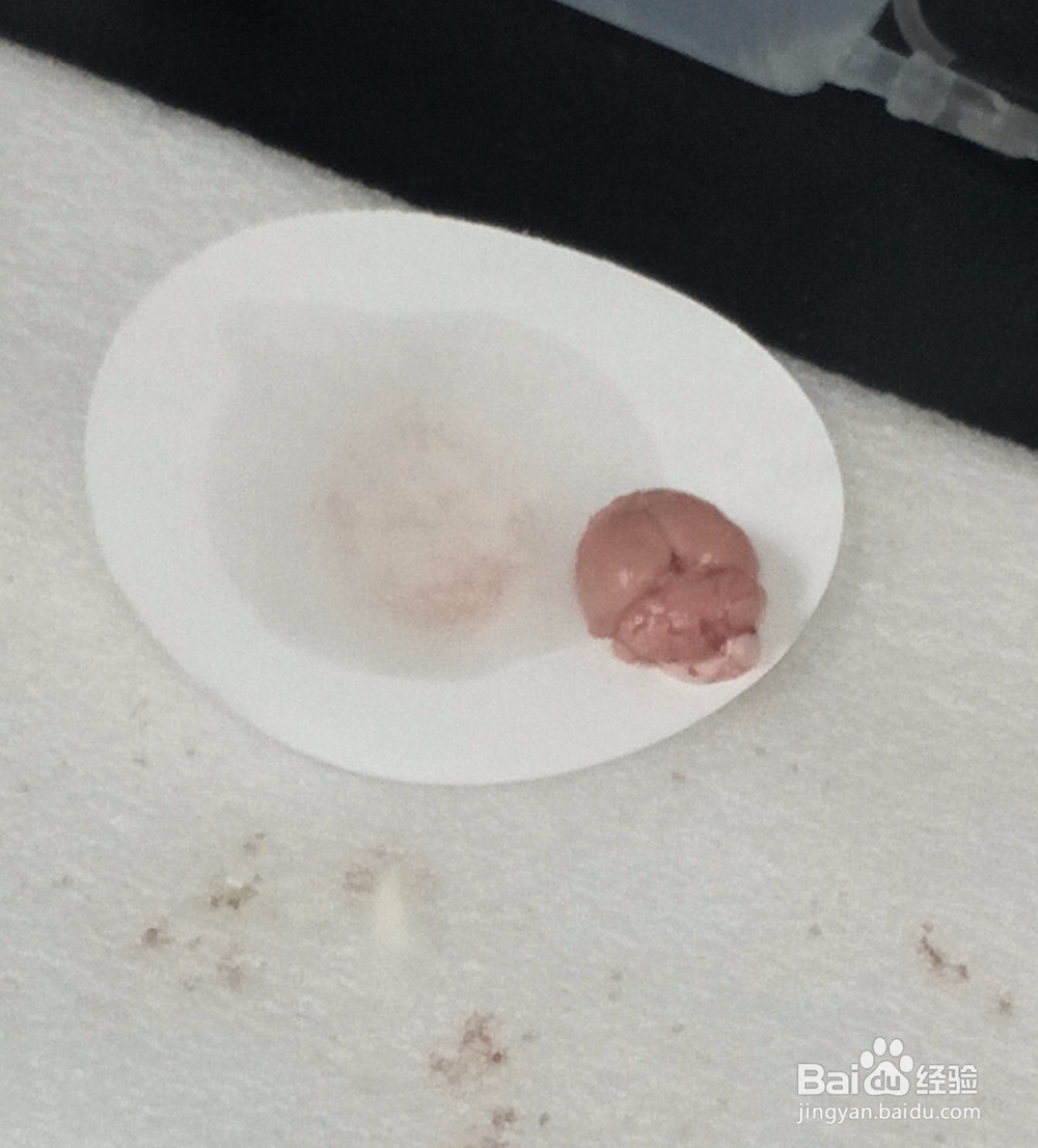 大白鼠取脑组织步骤