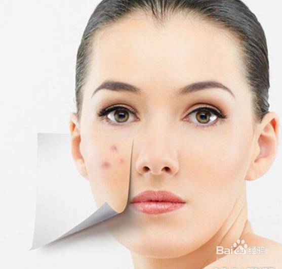 脸上长痘痘怎么清除