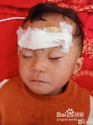 婴儿从床上掉下来怎么办