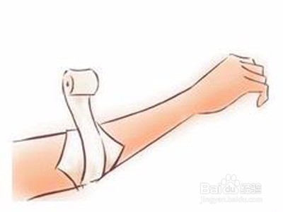 被打过疫苗的小猫咬出血了怎么办