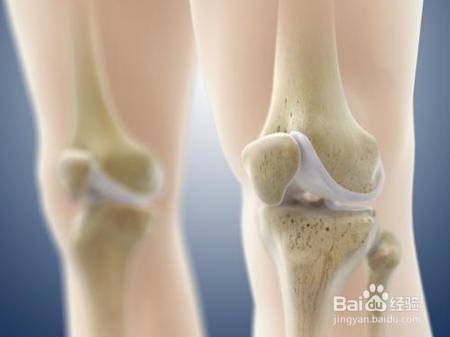 膝盖疼的人不用再四处问药了，两个洋葱搞定！