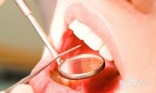 慢性咽炎症状表现哪些,用什么方法治疗