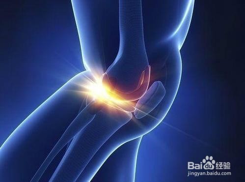 髌骨软化症治疗三步骤