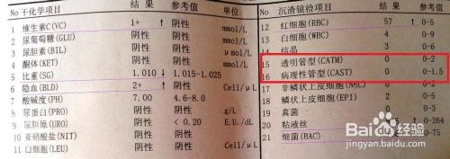 尿液报告单怎么看（干化学方法和镜检）