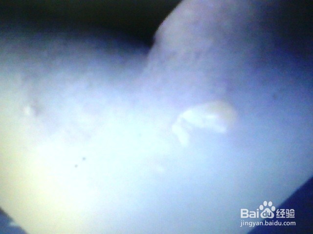 宝宝灼伤/烫伤，该怎么办？