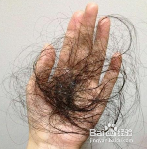 改善脱发的方法有哪些?