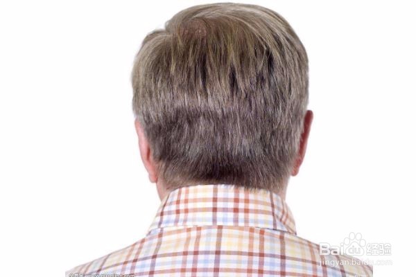 如何从白发的位置判断健康状况？