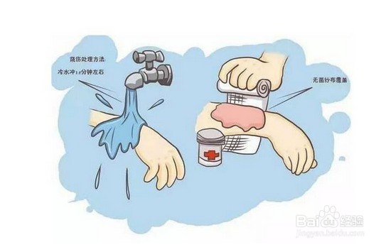 宝宝被烫到了，怎么办？！