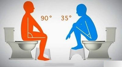 便秘人群如何轻松缓解如厕问题