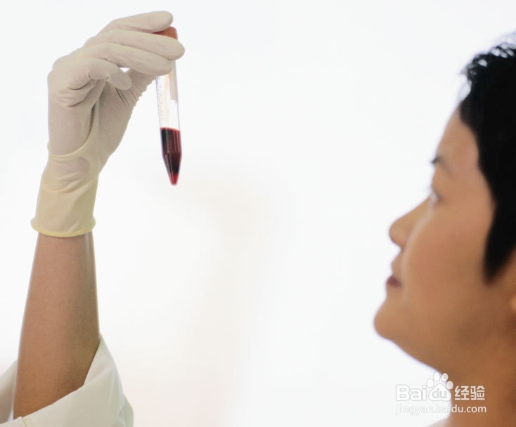 做肾功能检查需要注意哪些事项？