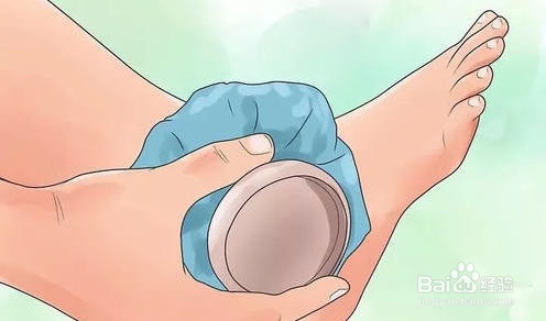 如何让蚊子咬的包快速消失