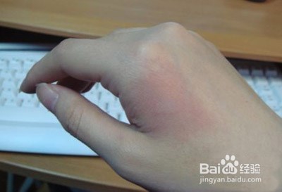 高温天气不要轻易触碰的东西