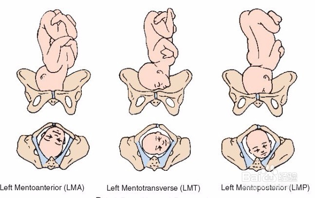 胎位loa位置图图片