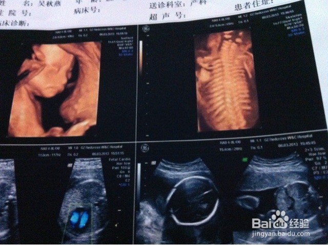 孕检查什么