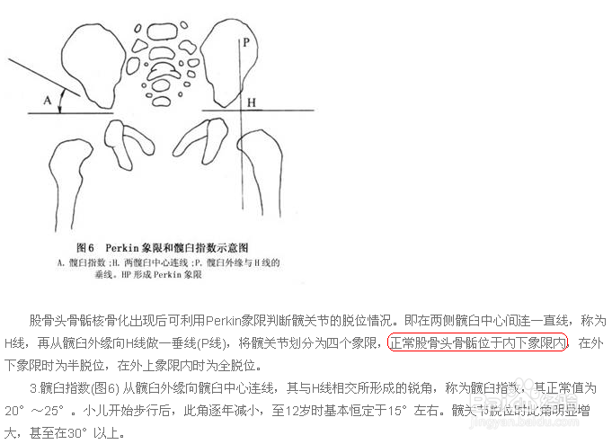 怎么在X线平片上确诊先髋