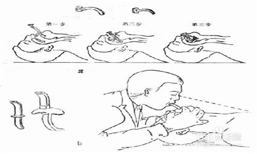 简易呼吸器如何使用