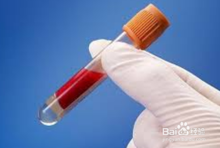 血型影响腹泻的严重程度