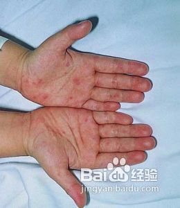 怎样去除苯污染