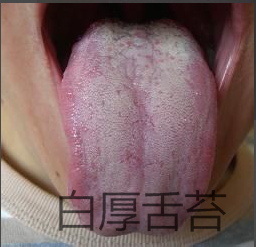 中医胃症有哪几个类型、其主要临床表现是什么