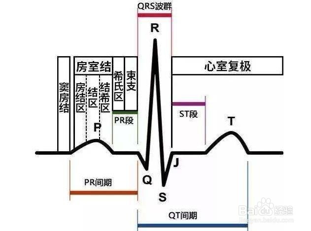 心电图怎么看,心电图讲解,心电图t波改变