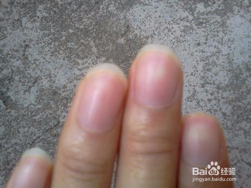 手指甲有点泛白是什么原因