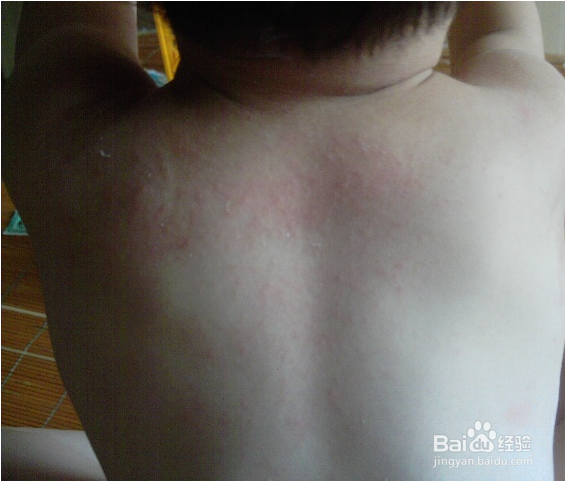 夏天怎么预防宝宝长痱子？