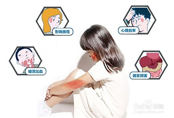 鲜红斑痣能彻底治愈吗，鲜红斑痣能自行消退吗？