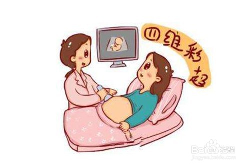 哪几次产检是必须要做的