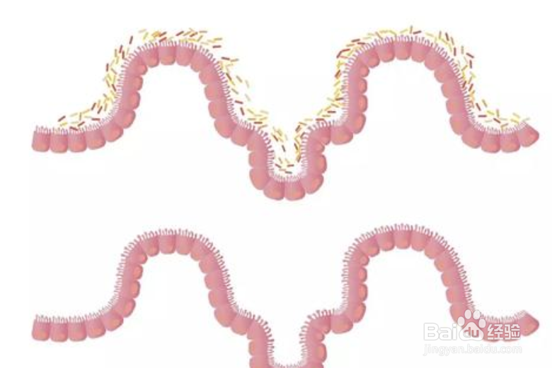 怎么让肠道更健康