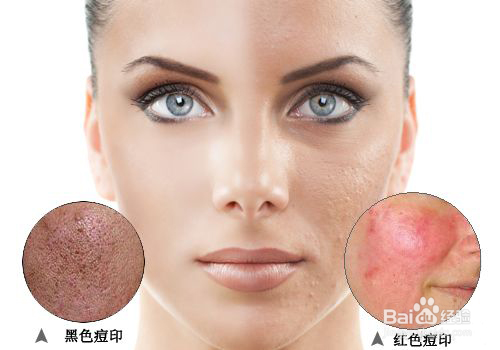 如何进行夏日美白