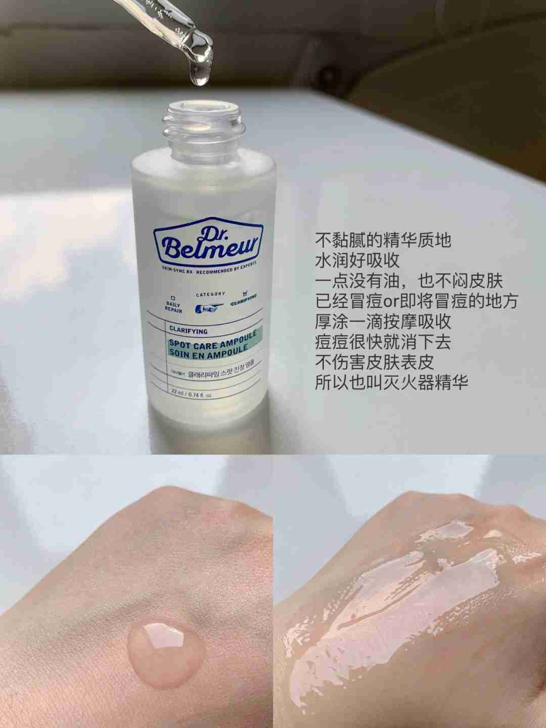 油敏痘肌护肤 | 韩国女生没有痘痘的秘诀