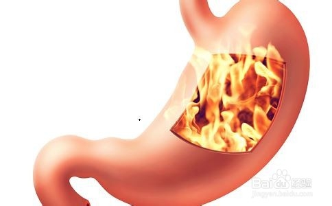 盘点最伤胃的食物